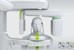 CBCT 3D Imaging System