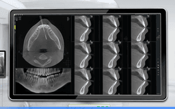 CBCT 3D Imaging System
